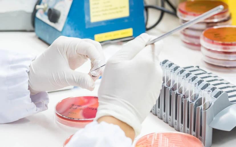 AI Solves Superbug Puzzle in 48 Hours, Stuns Scientists with Groundbreaking Discovery
